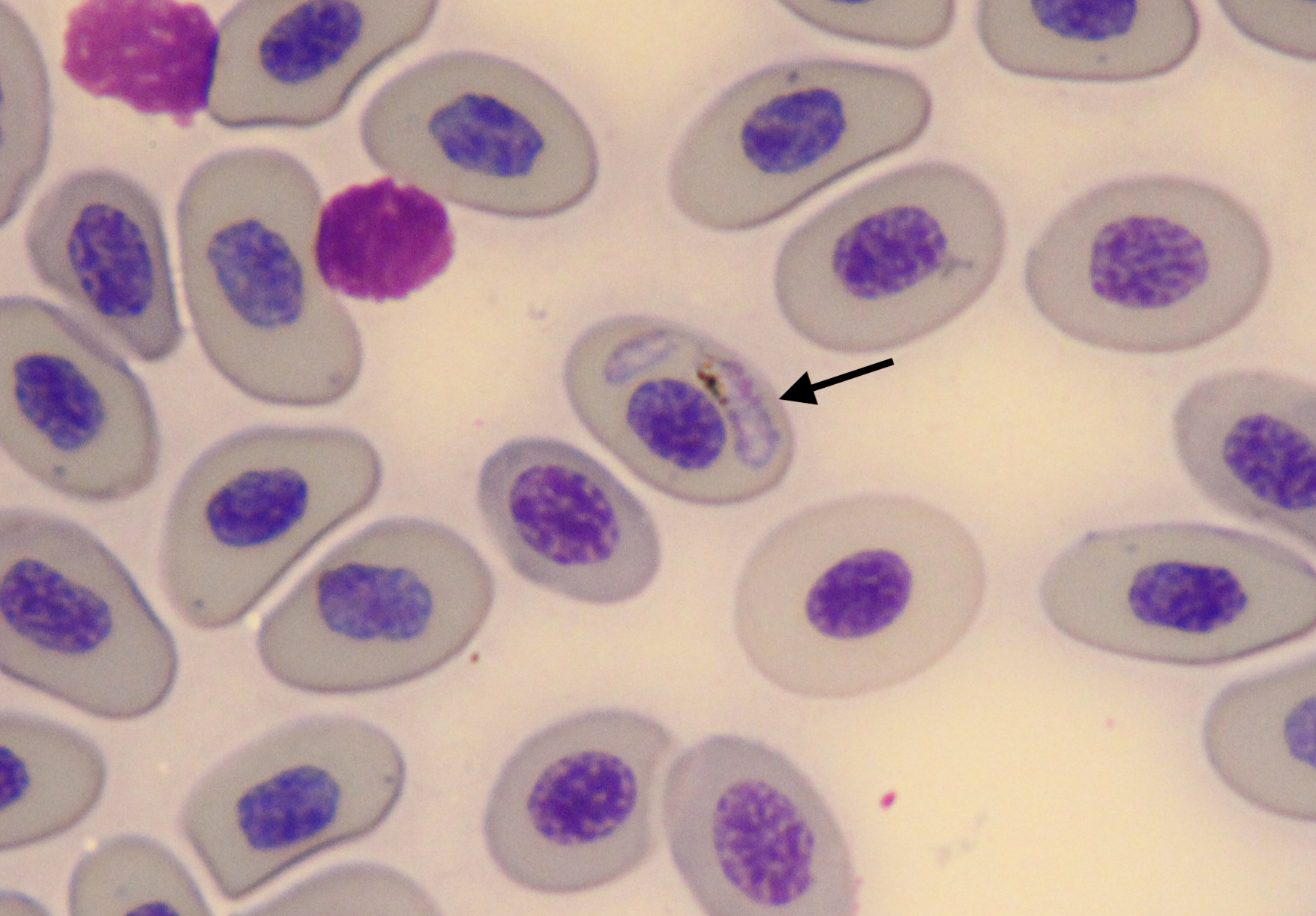 Slide showing a red blood cell infected with lizard malaria. Photo by Ari Torres.
